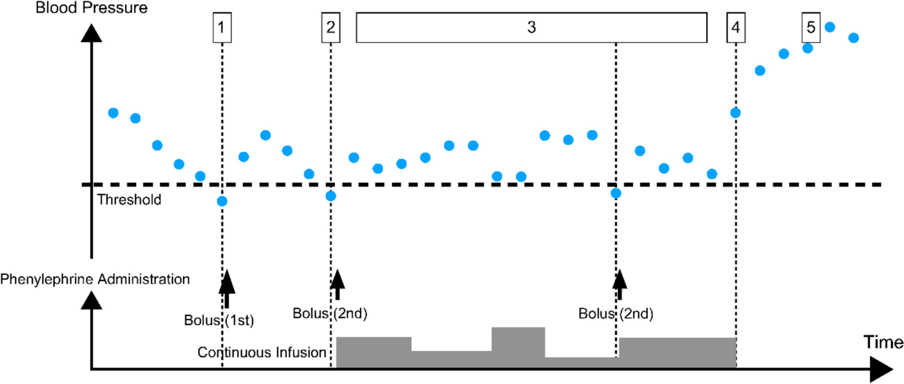 Development and evaluation of an automated phenylephrine delivery system by lower limit control for managing intraoperative hypotension