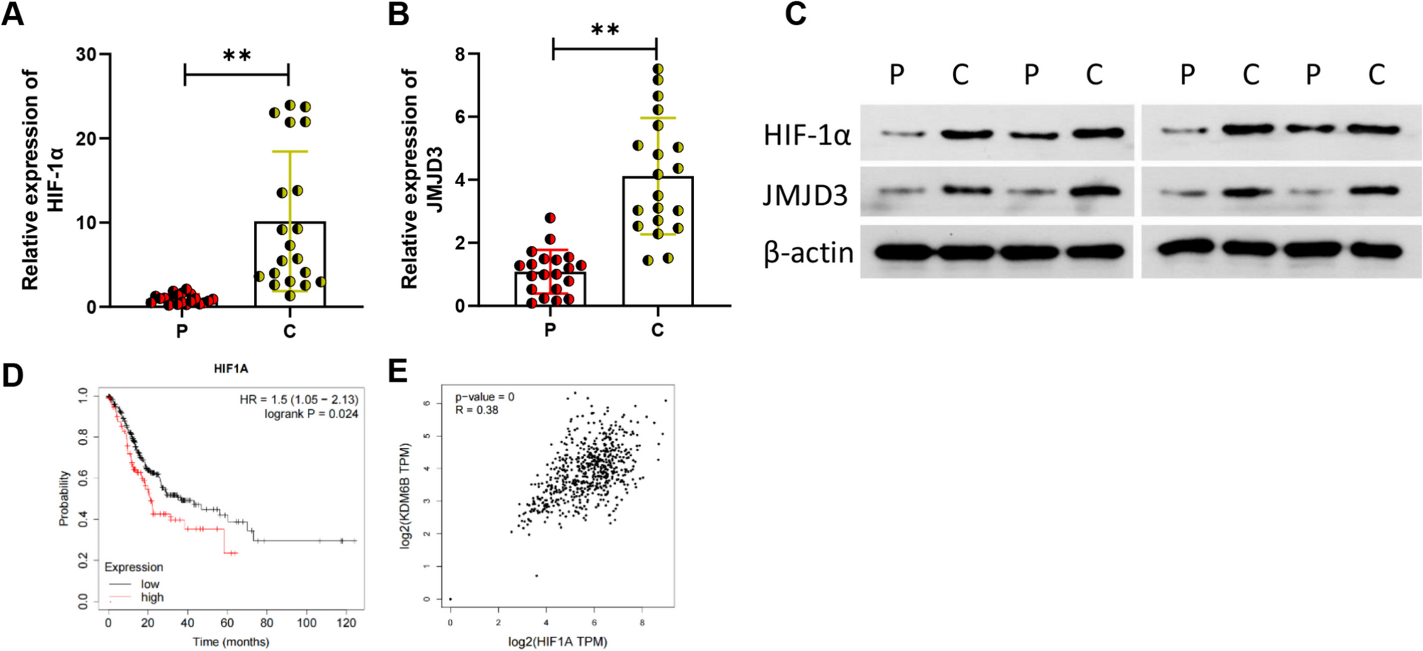 Targeting hypoxia-induced HIF-1α/JMJD3/Notch axis in gastric cancer therapy