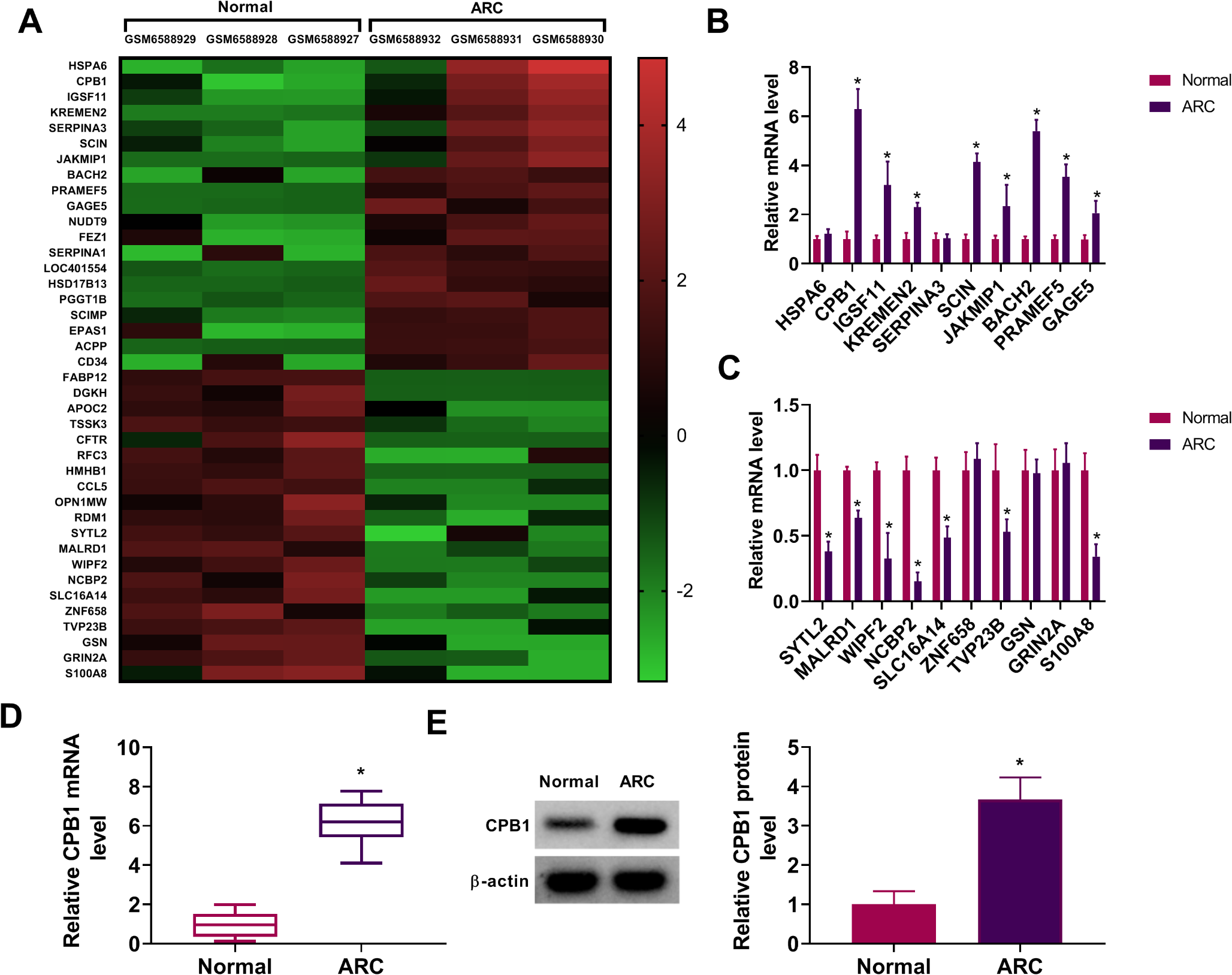 METTL3 mediates CPB1 expression by regulating transcription factor BACH2 to promote apoptosis and oxidative stress of lens epithelial cells