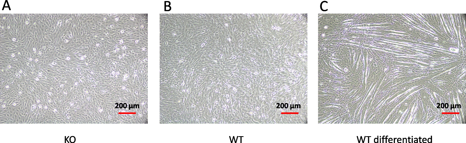 Mitochondrial glutamic-oxaloacetic transaminase (GOT2) in the growth of C2C12 myoblasts