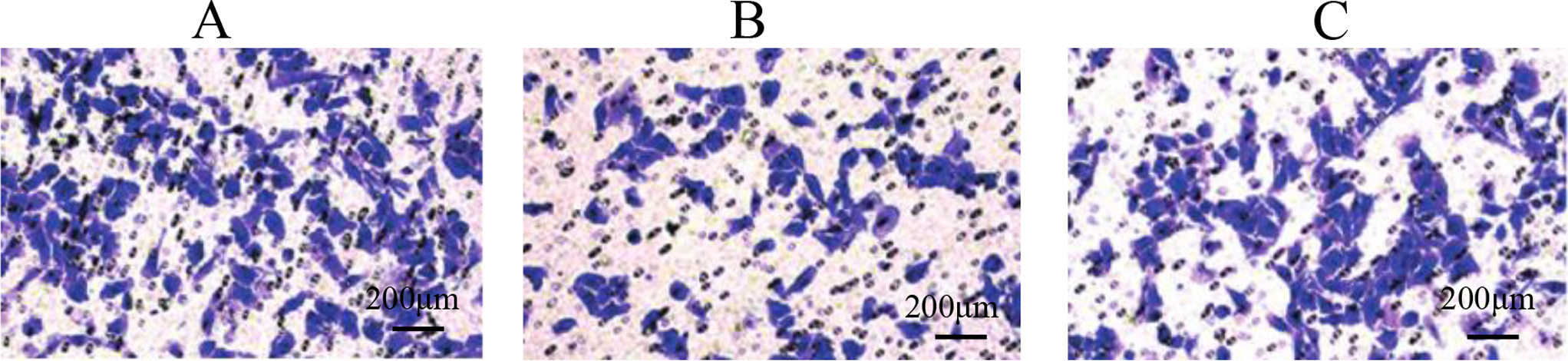 Sirt6 regulates the Notch signaling pathway and mediates autophagy and regulates podocyte damage in diabetic nephropathy