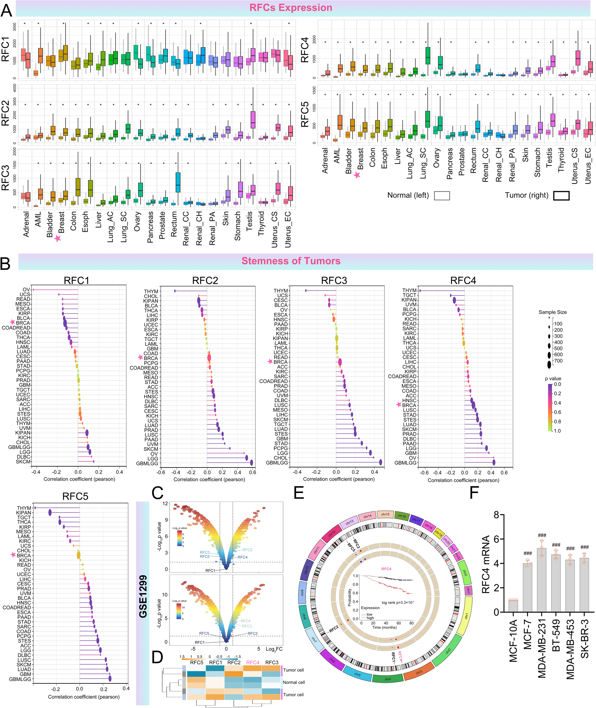 Replication factor C4, which is regulated by insulin-like growth factor 2 mRNA binding protein 2, enhances the radioresistance of breast cancer by promoting the stemness of tumor cells