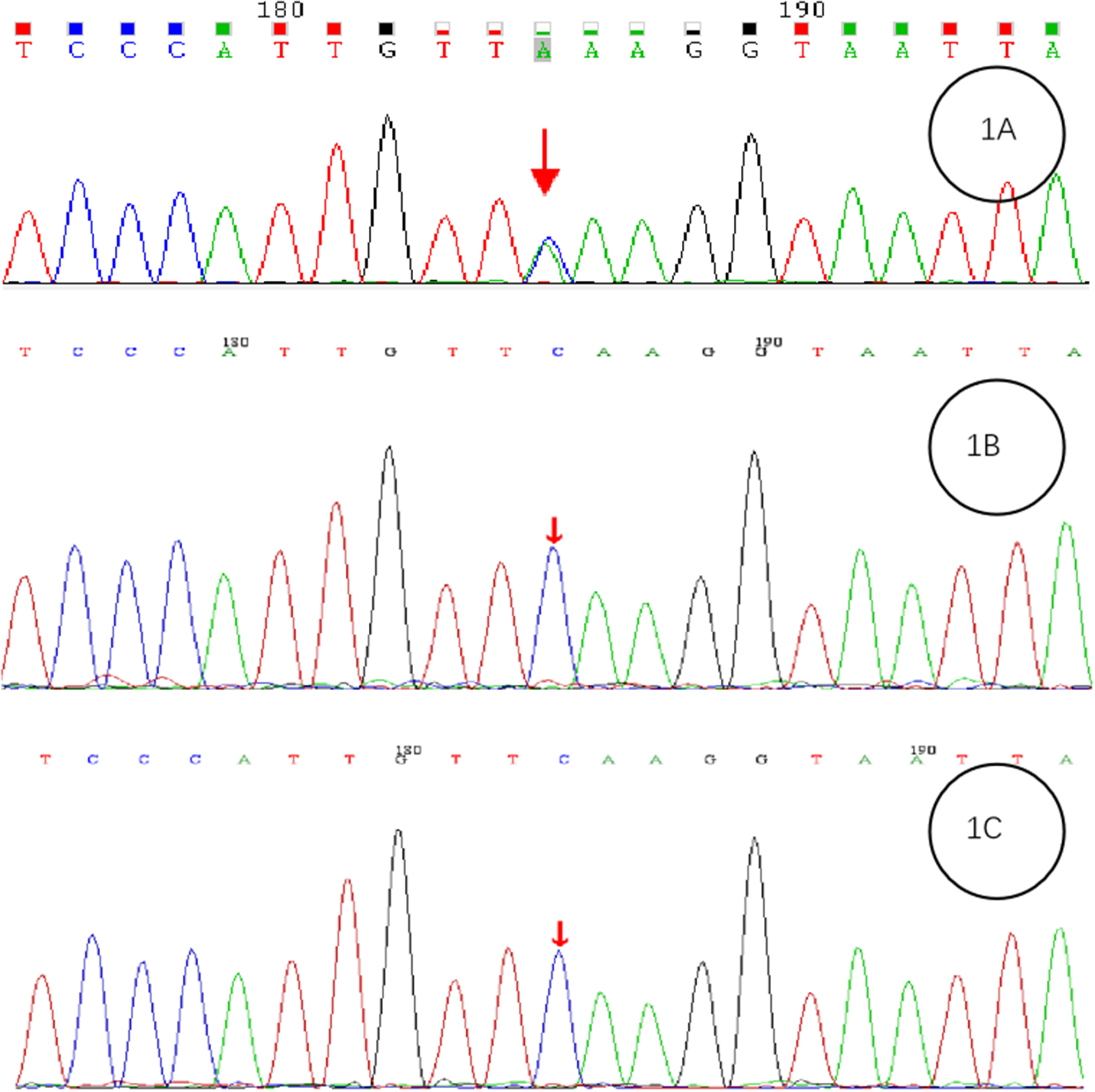 Genotypic and clinical phenotypic analysis of  gene mutations