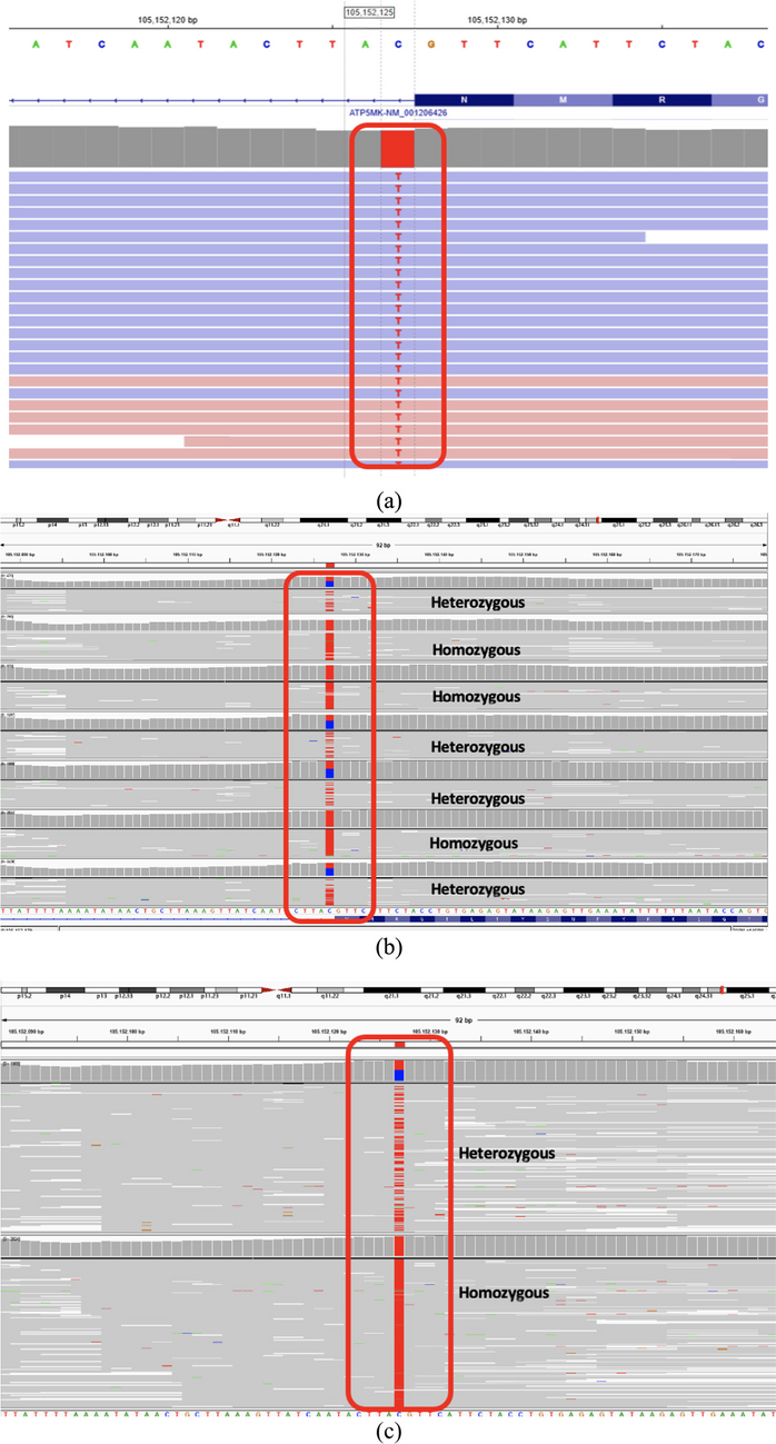 The fourth family in the world with a novel variant in the  gene: four siblings with complex V (ATP synthase) deficiency