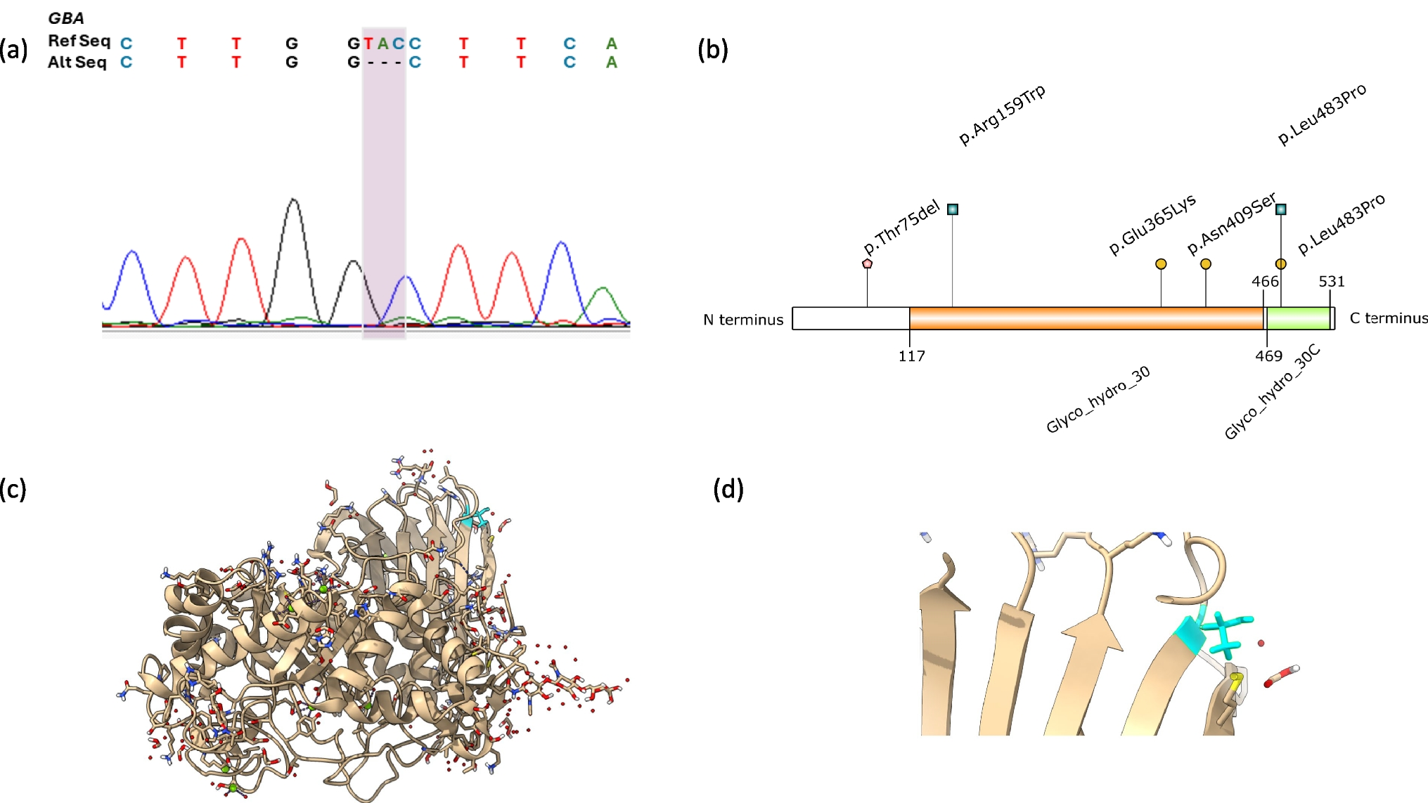 Early-onset Parkinson's disease in a patient with a rare homozygous pathogenic  variant and no Gaucher disease symptoms