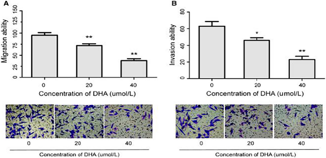 Correction to: Dihydroartemisinin suppresses glioma proliferation and invasion via inhibition of the ADAM17 pathway