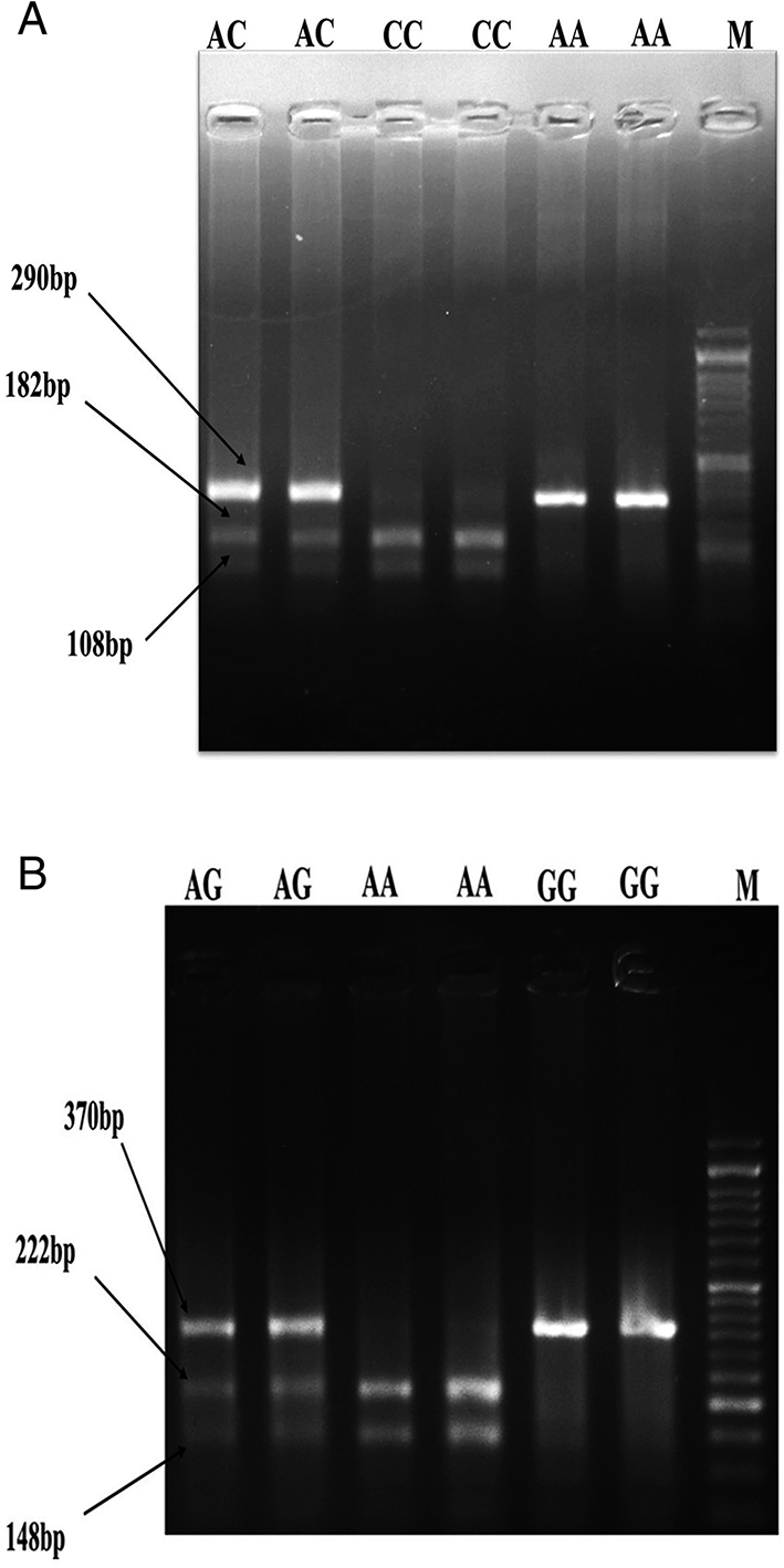 Utility and Sensitivity of  Gene Polymorphism in Early Prediction and Association with Risk of Metabolic Primary Antiphospholipid Syndrome: Cohort Study