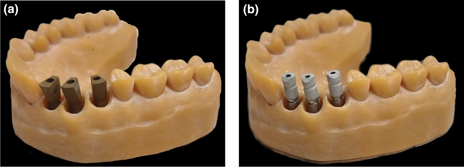 Differences between laboratory scanner and intra-oral scanner regarding axes and distances of three implants in a curved line when using two types of intra-oral scan bodies: in vitro study