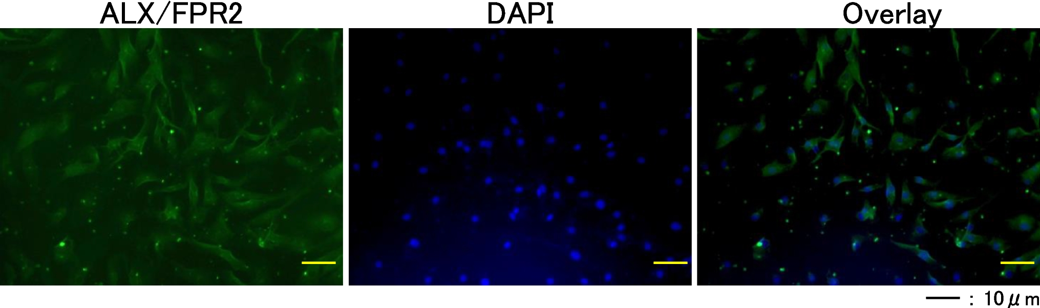 Resolvin D1 suppresses inflammation in human fibroblast-like synoviocytes via the p-38, NF-κB, and AKT signaling pathways