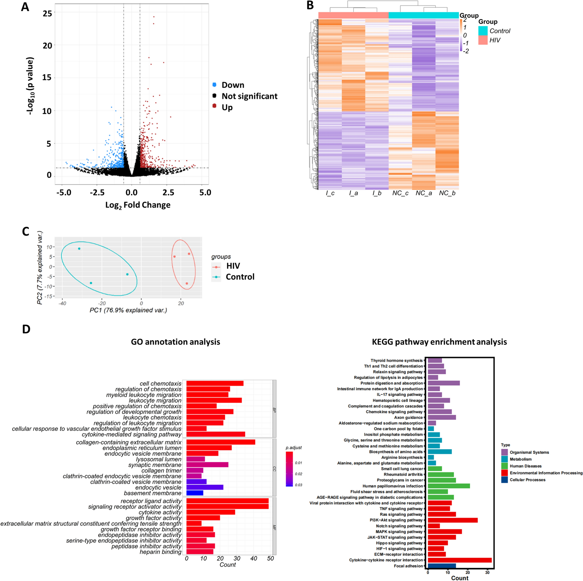 Integration of Transcriptomics and Metabolomics Reveals Metabolism Dysregulation in HIV-1-Infected Macrophages