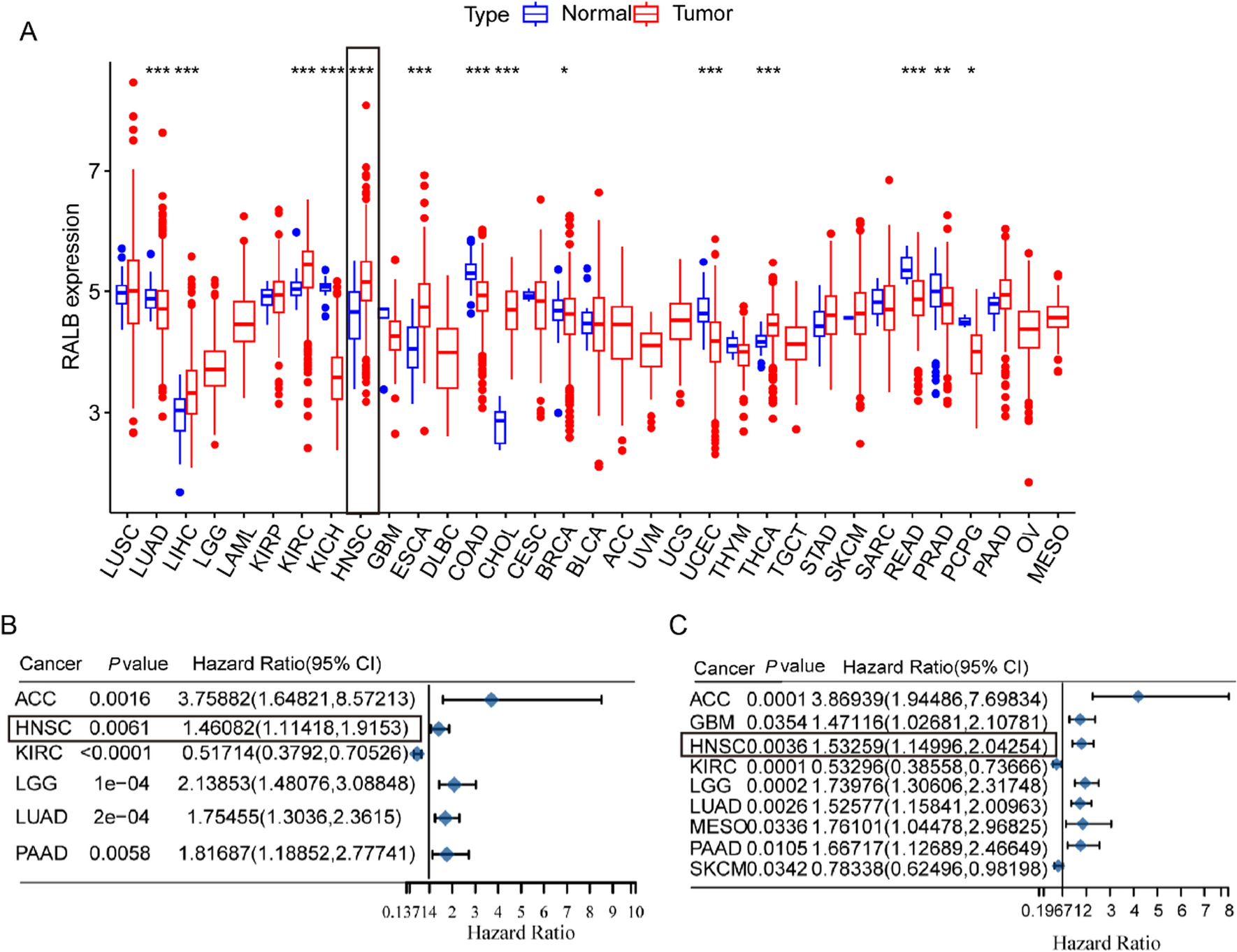 RalB promotes lymph node metastasis in tongue squamous cell carcinoma