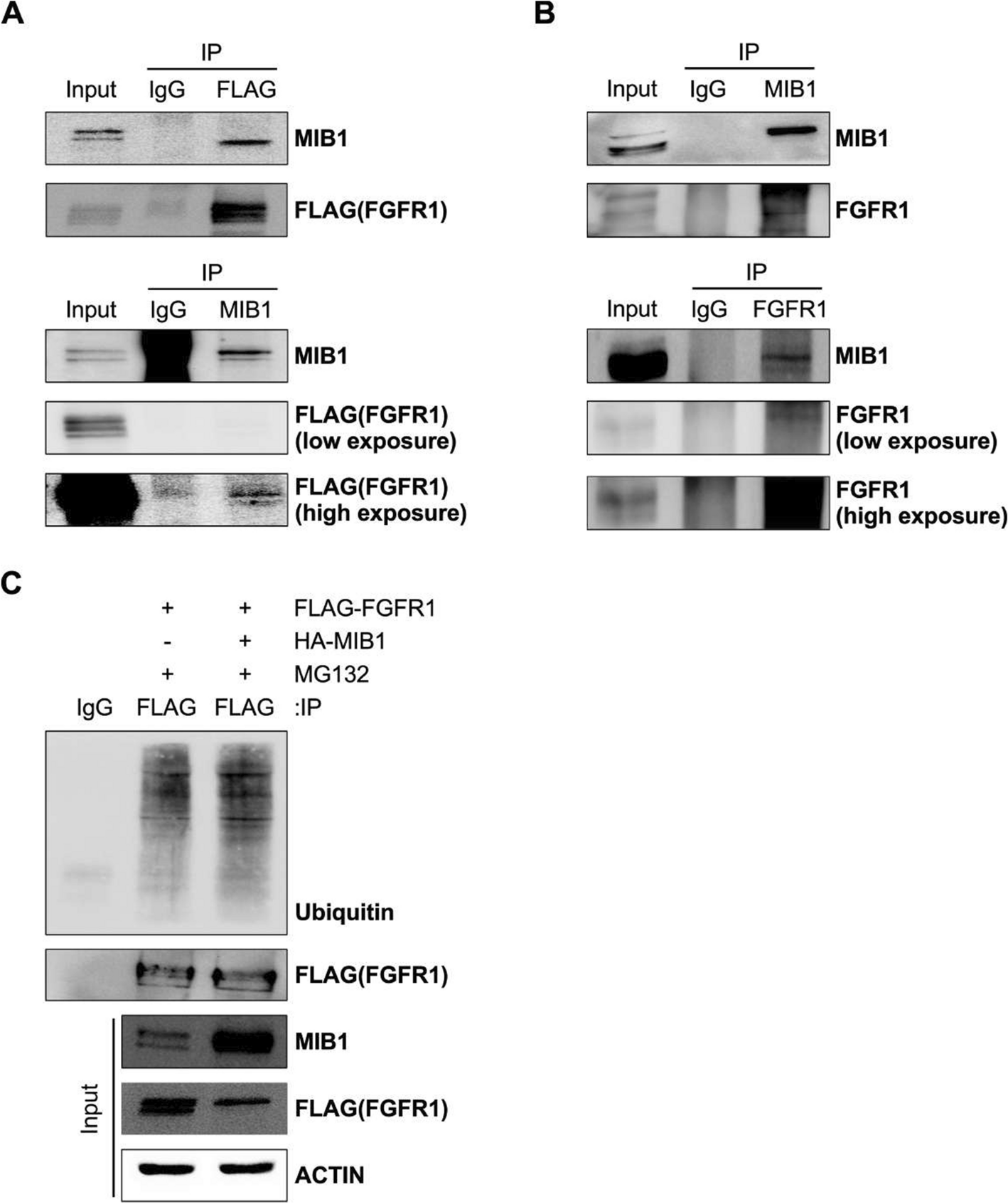 E3 ligase MIB1 regulates STAT1/P21 signaling via regulation of FGFR1 in colorectal cancer