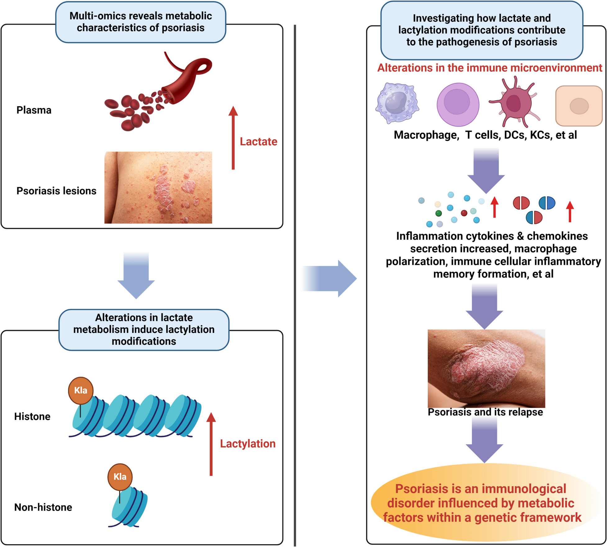 The Role of Lactate and Lactylation in the Dysregulation of Immune Responses in Psoriasis
