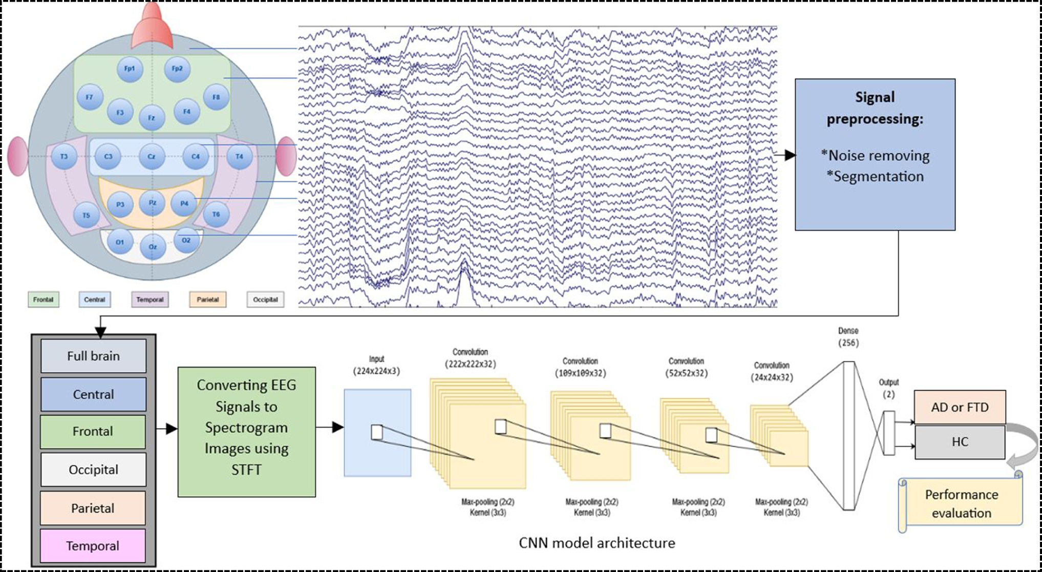 Investigating Brain Lobe Biomarkers to Enhance Dementia Detection Using EEG Data