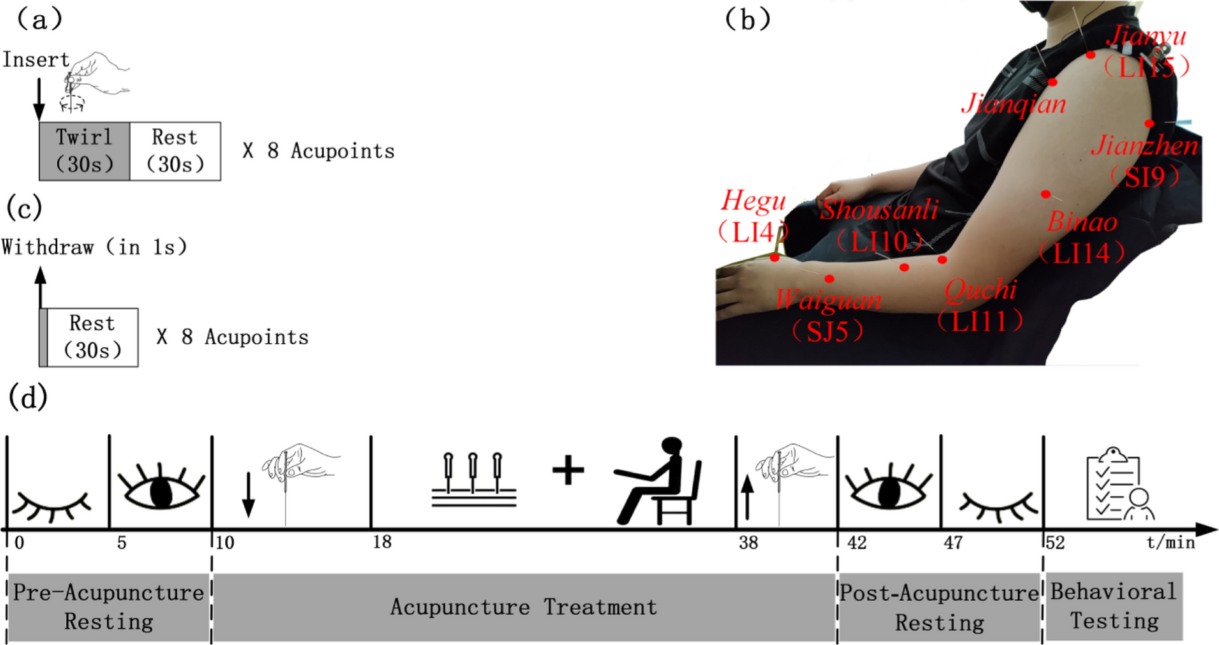 The potential associations between acupuncture sensation and brain functional network: a EEG study