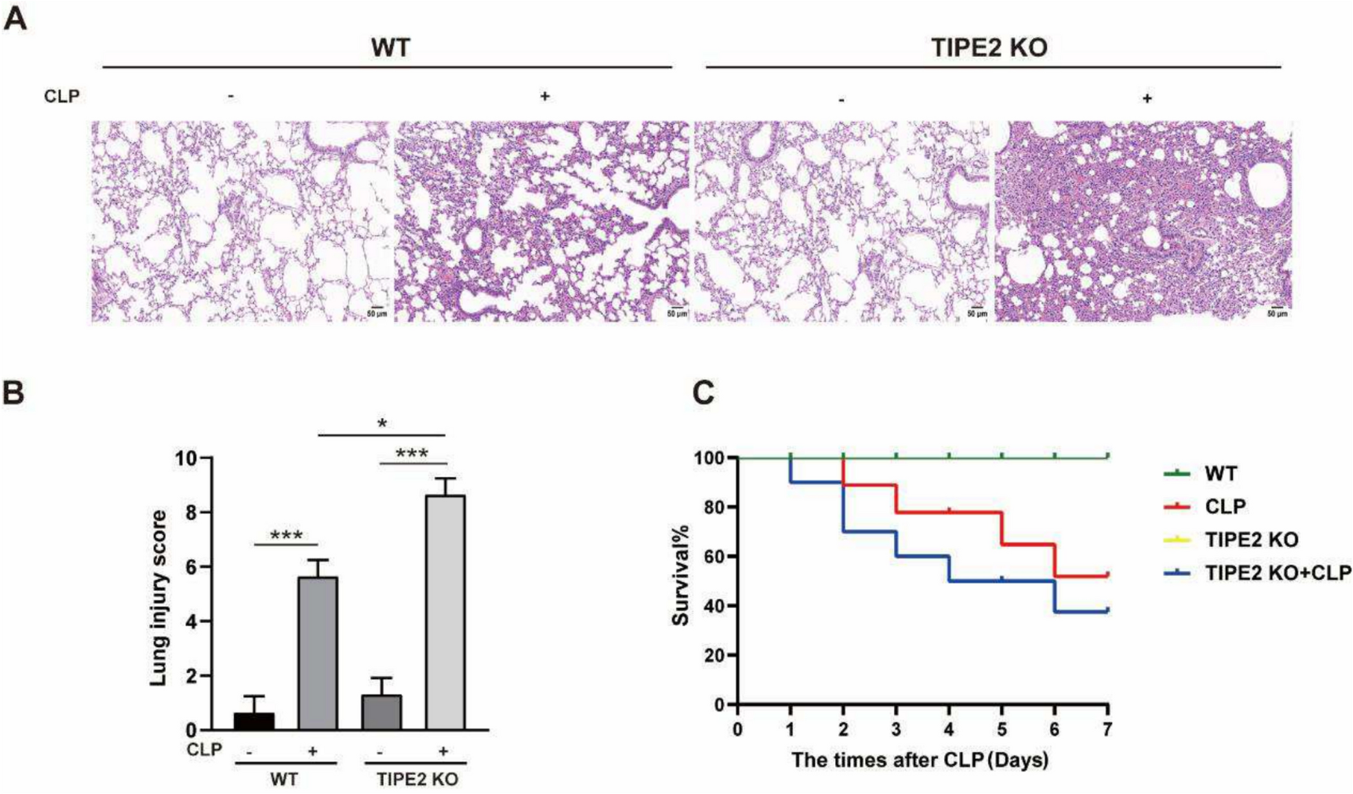 TIPE2 Alleviates Sepsis-induced Lung Injury By Inhibiting PANoptosis in Murine Alveolar Macrophages