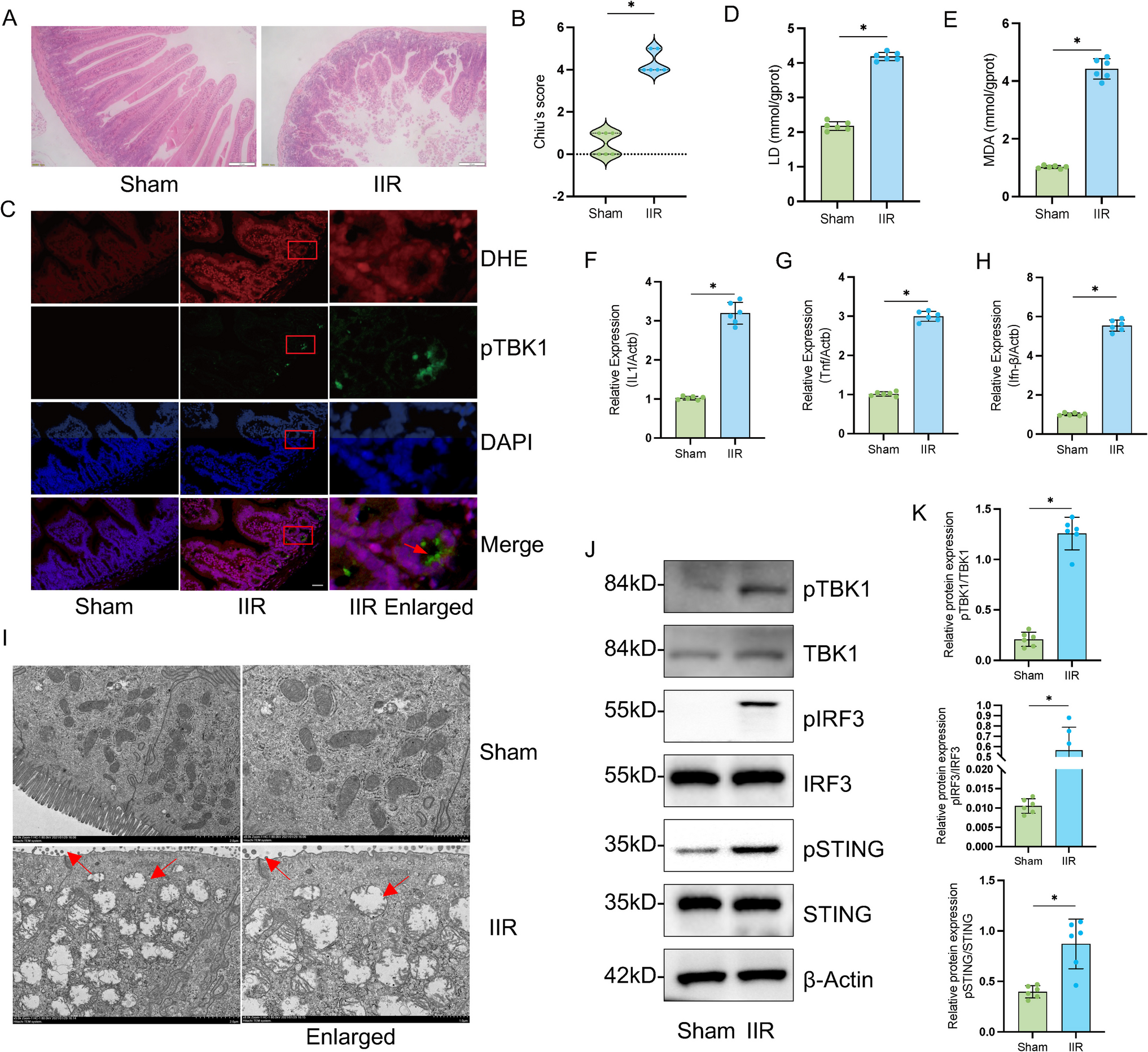 TFAM Deficiency Triggers mtDNA Leakage and cGAS-STING-Mediated Intestinal Ischemia–Reperfusion Injury