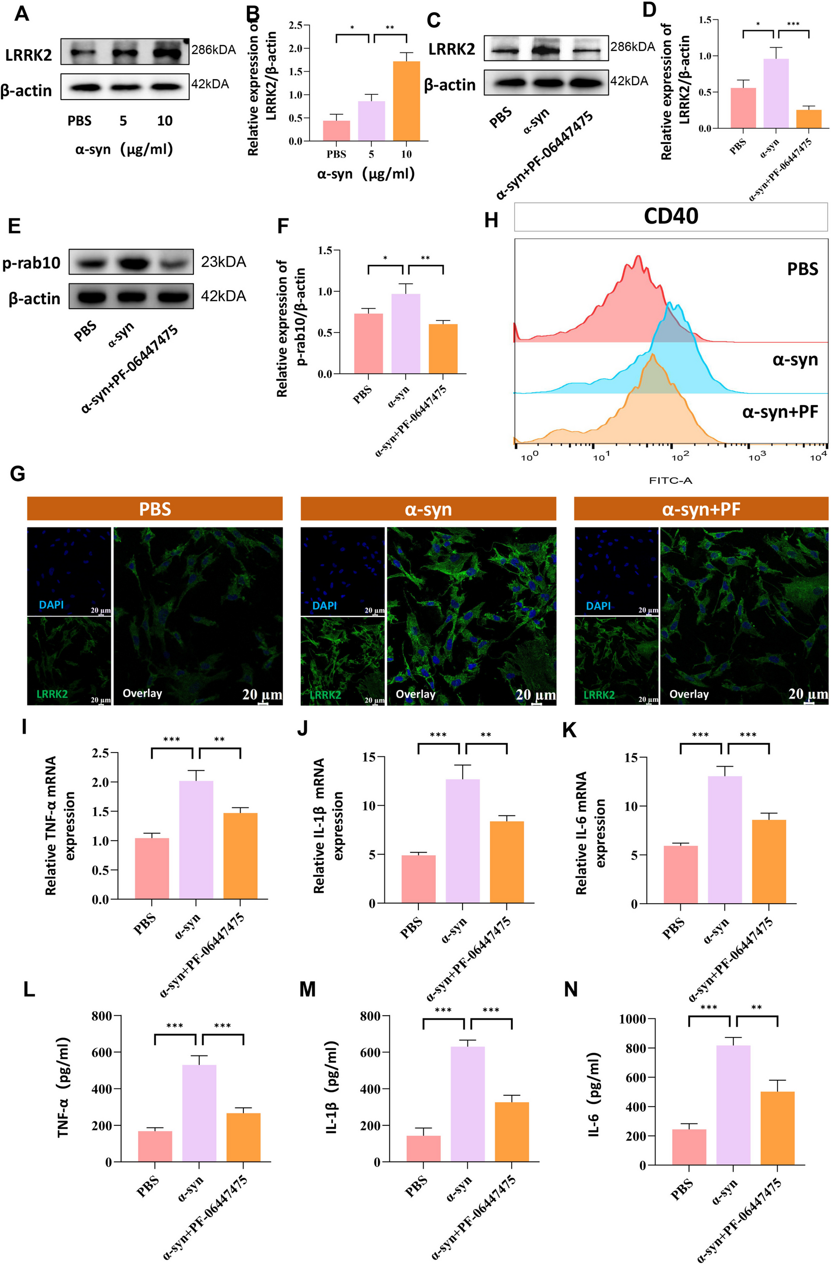 LRRK2 Mediates α-Synuclein-Induced Neuroinflammation and Ferroptosis through the p62-Keap1-Nrf2 Pathway in Parkinson’s Disease