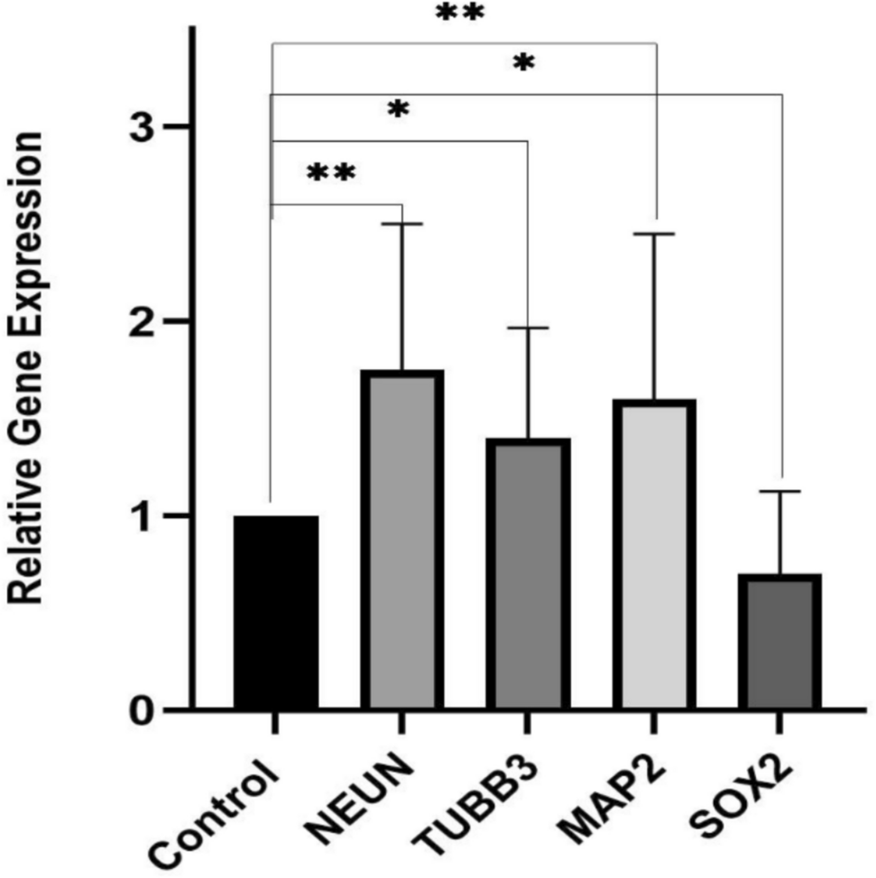 Dual Mechanism of Docosahexaenoic acid (DHA) in Alzheimer’s Disease: PAD4 Inhibition and Autophagy Stimulation