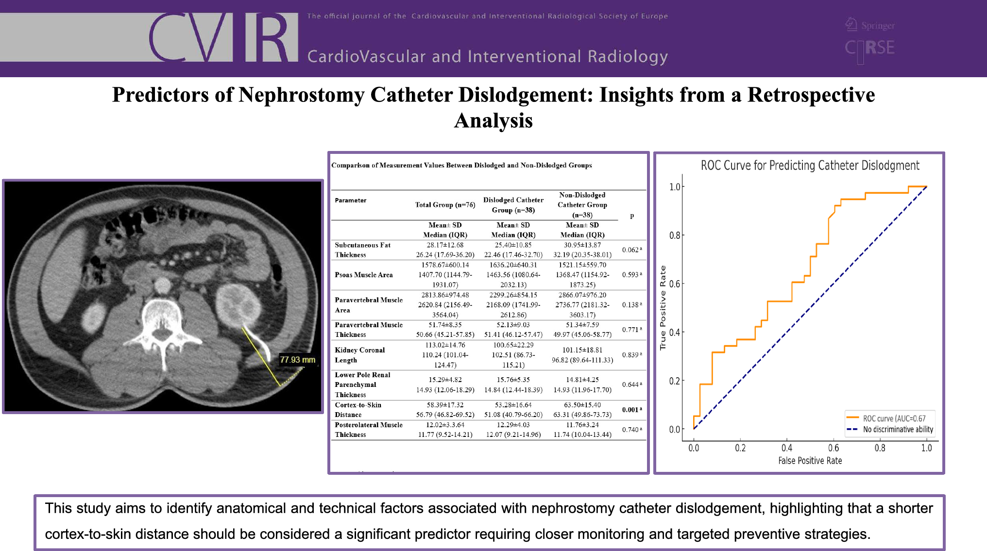 Predictors of Nephrostomy Catheter Dislodgement: Insights from a Retrospective Analysis
