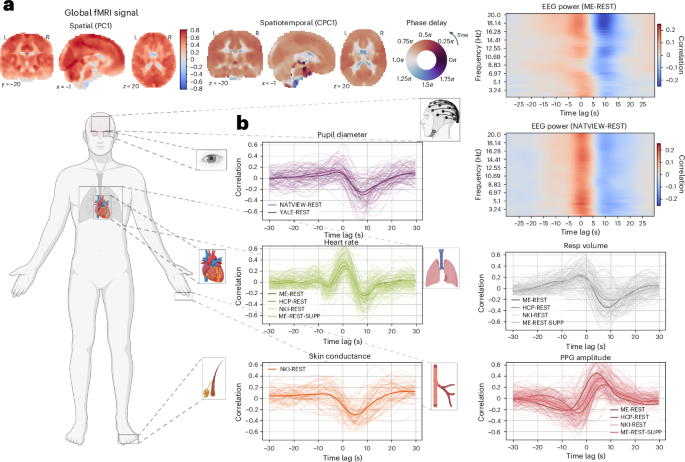 Widespread brain–body integration during changes of arousal