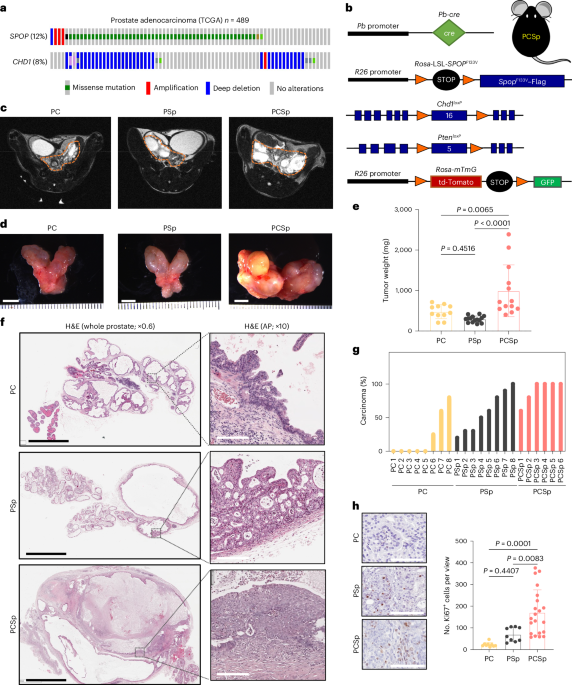 CHD1 loss reprograms SREBP2-driven cholesterol synthesis to fuel androgen-responsive growth and castration resistance in SPOP-mutated prostate tumors