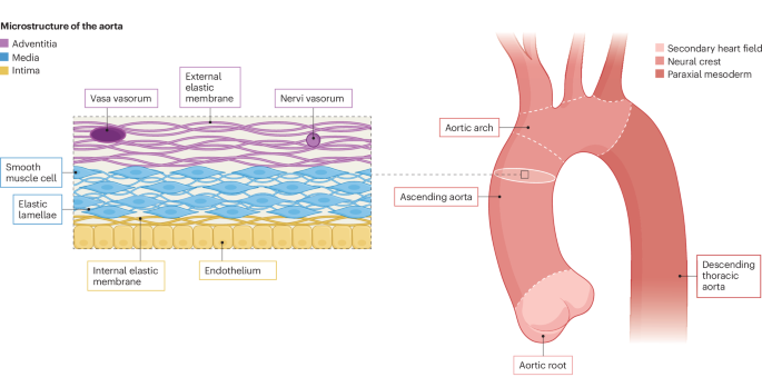 Thoracic aortic aneurysm