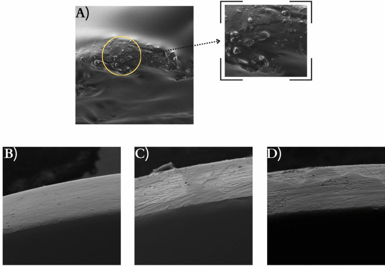 Film-forming spray loaded with essential oil: preparation, characterization and successful treatment of alopecia by hair restoration density