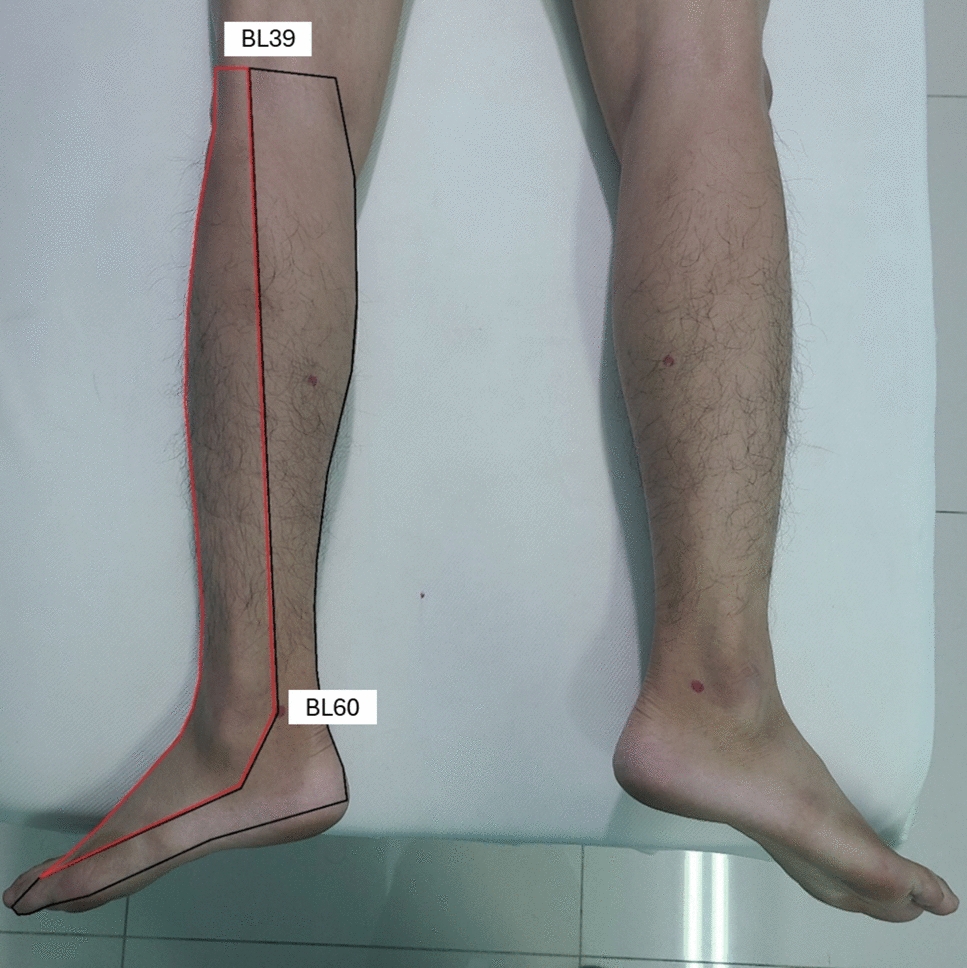 A non-randomized, self-controlled pilot study investigated the temperature change effect of bilateral BL65 shu-stream acupoint on the corresponding meridian