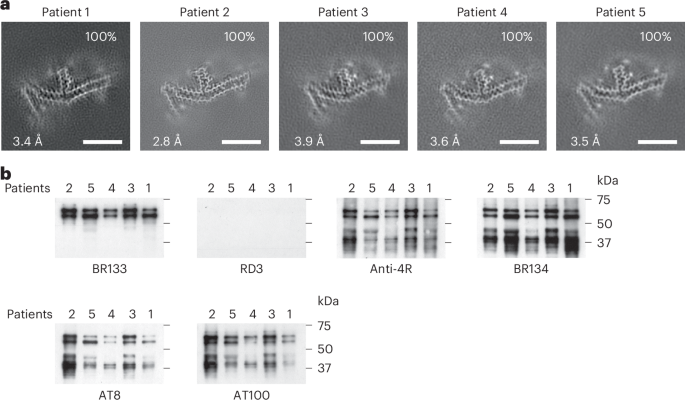 Distinct tau filament folds in human MAPT mutants P301L and P301T