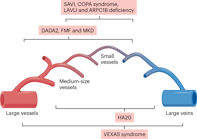 The pathogenesis, clinical presentations and treatment of monogenic systemic vasculitis