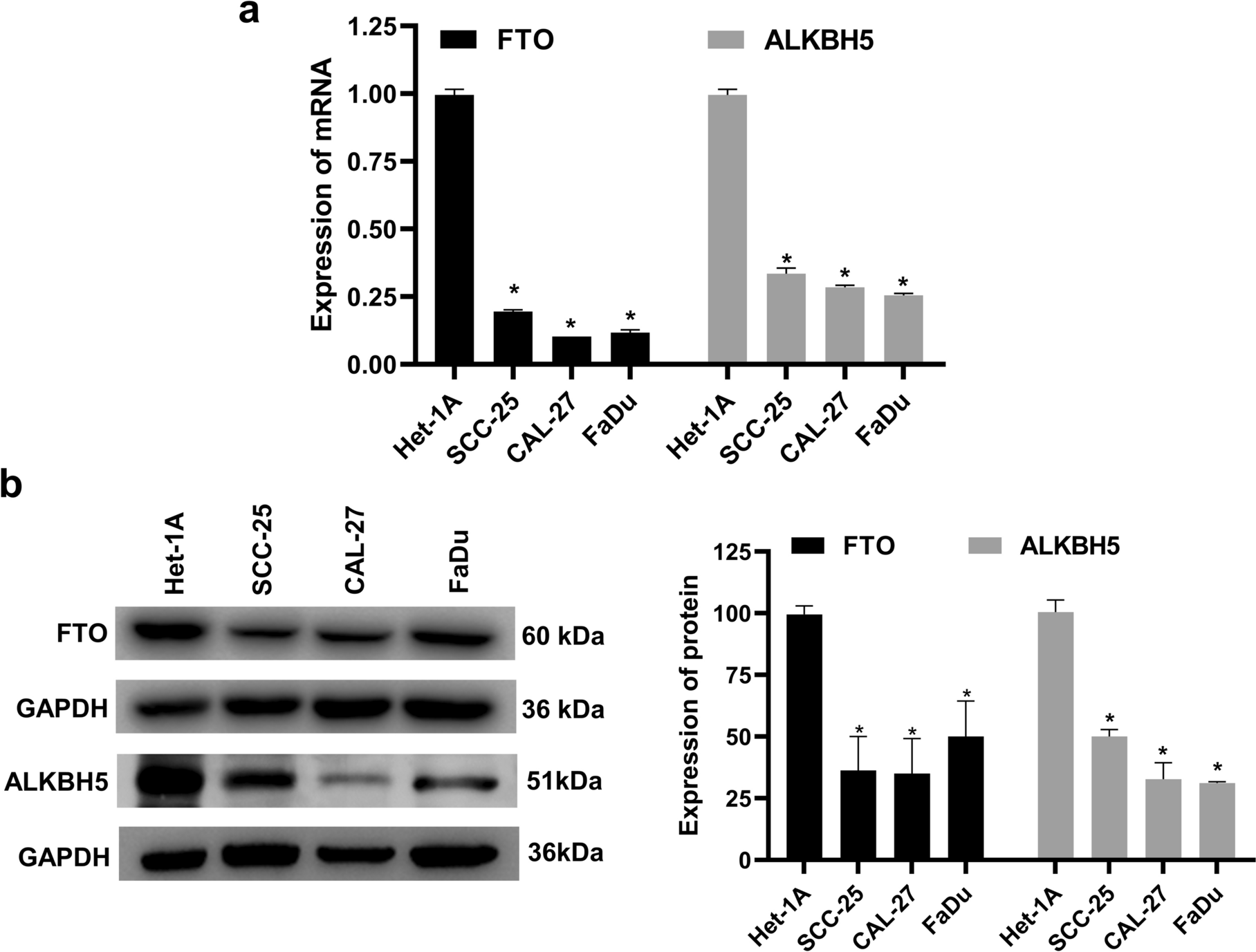 Tumor-suppressive role of m6A eraser proteins FTO and ALKBH5 in oral squamous cell carcinoma