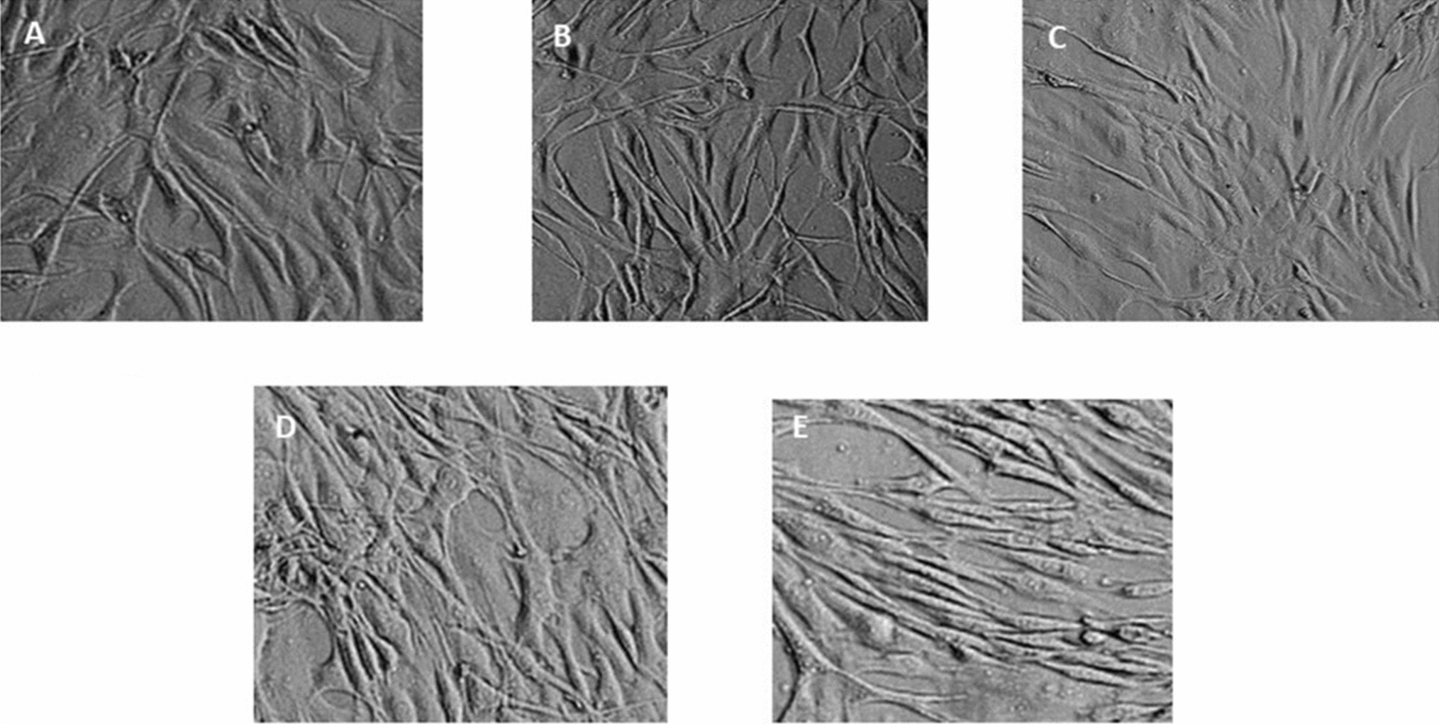 expansion of human disc chondrocytes from surgically removed disc tissue: Post-operative tissue stability