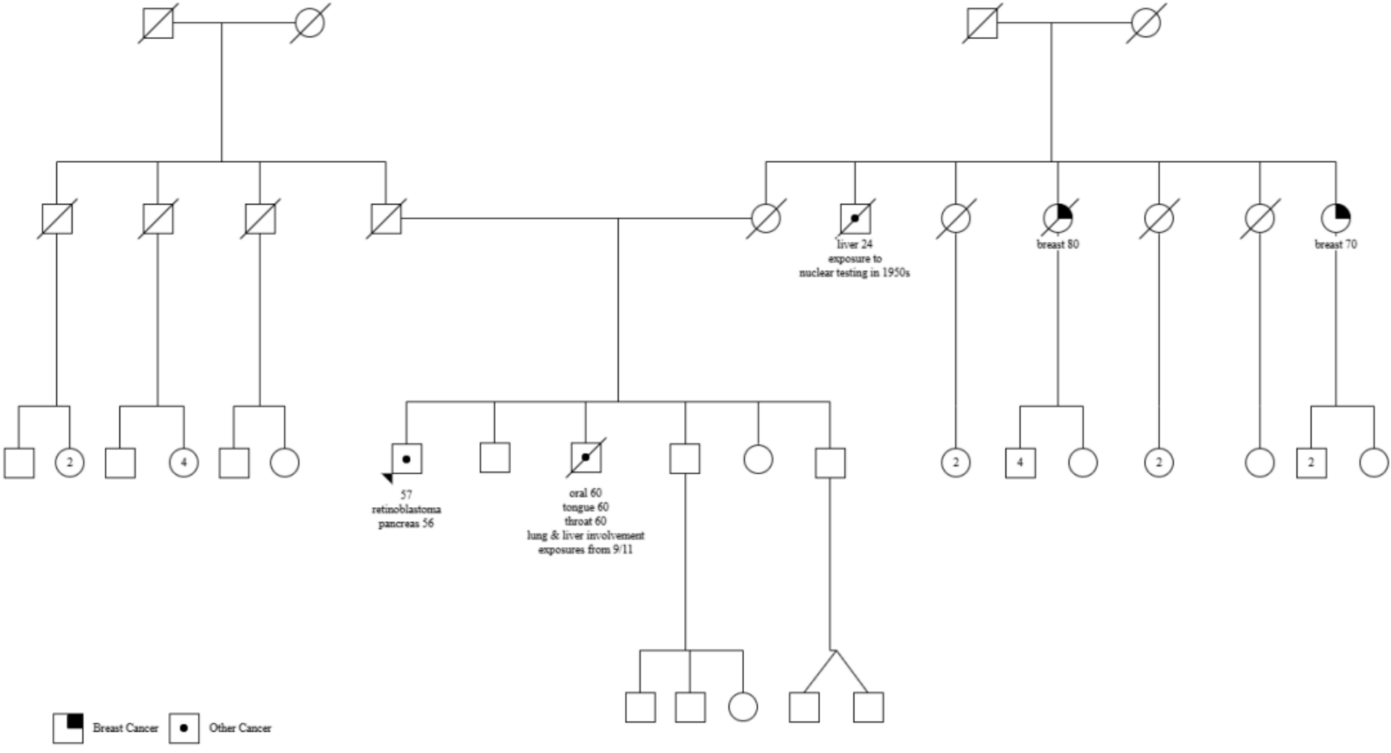 Pancreatic adenocarcinoma in a patient with a germline  pathogenic variant