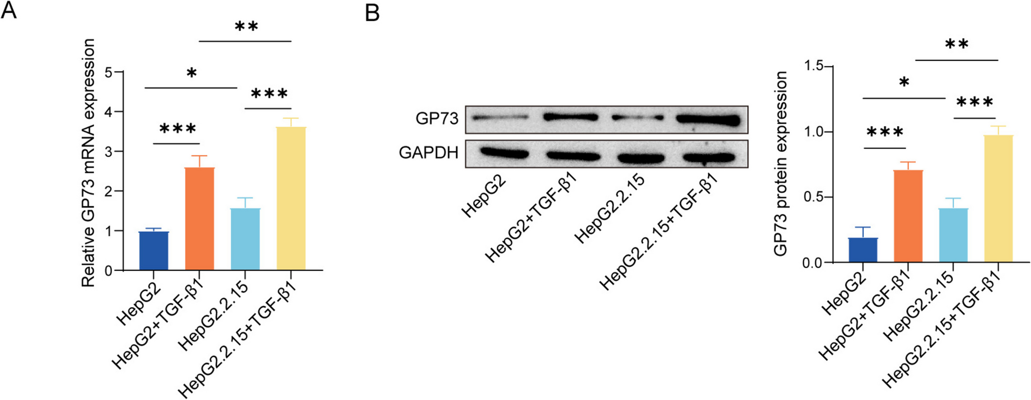 HBV infection upregulates GP73 expression to promote liver fibrosis by enhancing ER stress via the Smad2 pathway