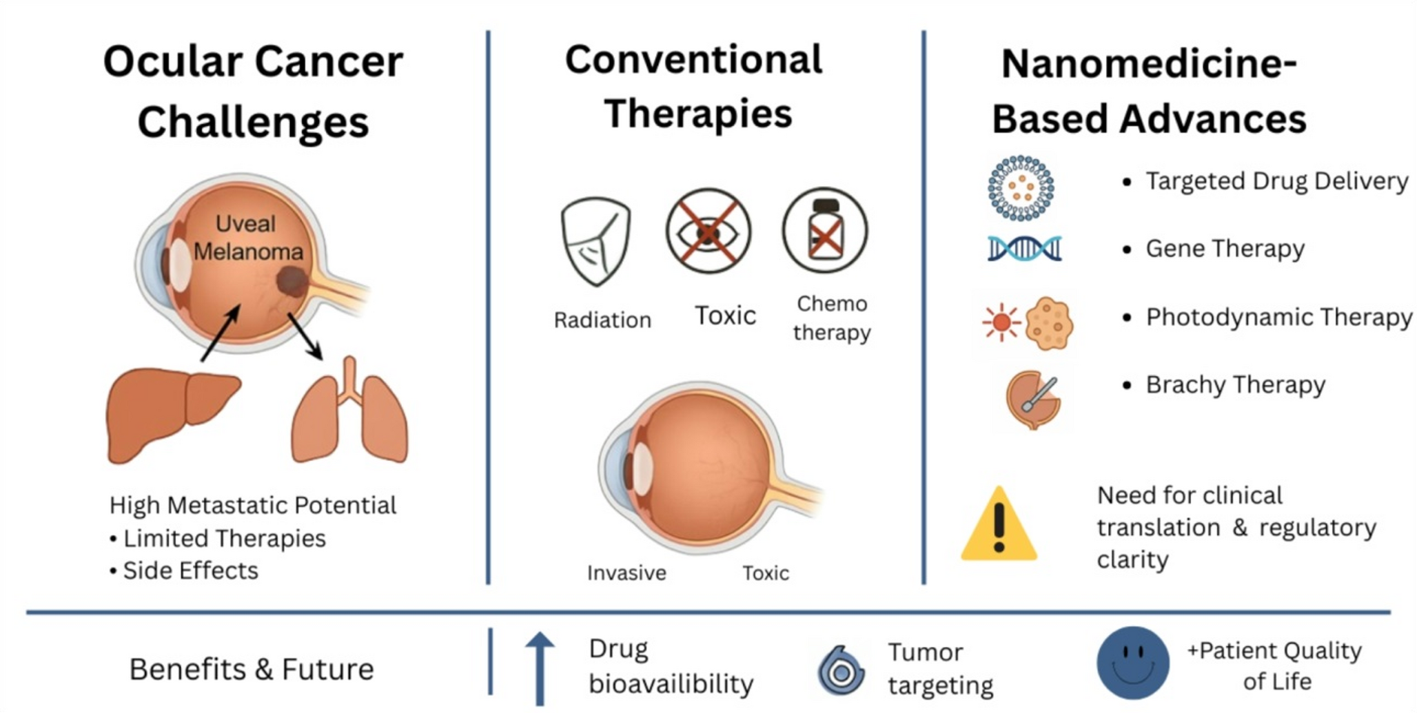 Nanomedicine-Based Treatments for Rare and Aggressive Ocular Cancers: Advances in Drug Delivery