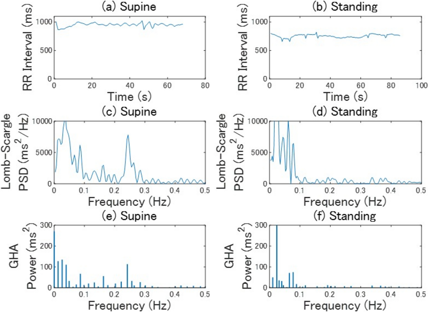 Diabetes mellitus narrows frequency band range of low-frequency components in heart rate variability