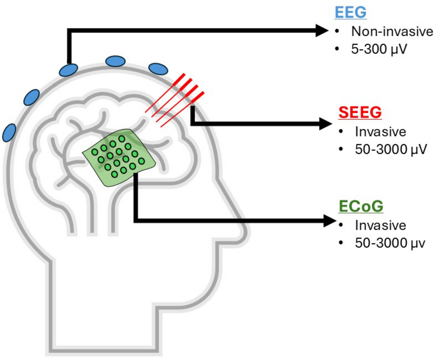 Machine learning detection of epileptic seizure onset zone from iEEG