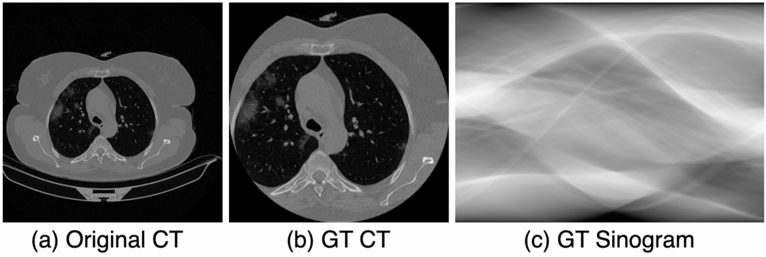 Efficient sparse-view medical image classification for low radiation and rapid COVID-19 diagnosis