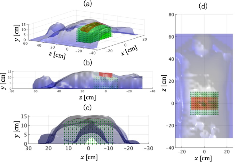 Sensor arrangement strategy for effective bowel sound source localization