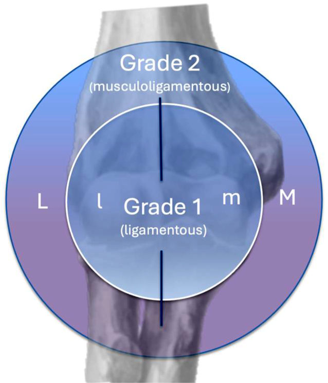 The Munich Elbow Soft Tissue (MEST) classification—a magnetic resonance imaging-based treatment algorithm for simple elbow dislocations