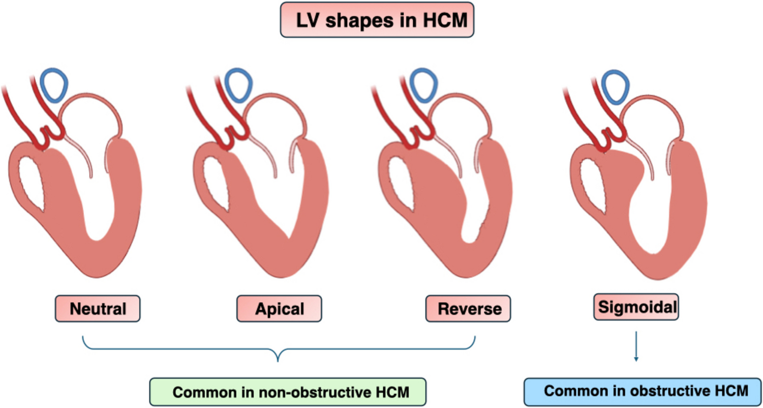 Unveiling the complexity of nonobstructive hypertrophic cardiomyopathy