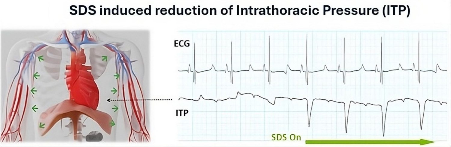 Synchronized diaphragmatic stimulation for the treatment of HFrEF—a review