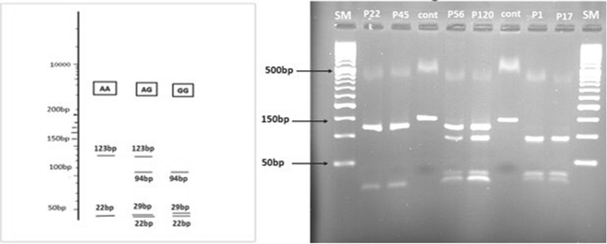 Effect of HER2 Ile655Val polymorphism on the response to trastuzumab treatment in HER2-positive breast cancer patients