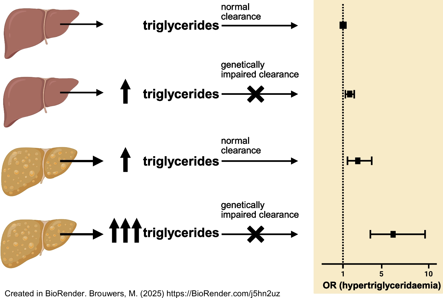 Steatotic liver disease interacts with a polygenic risk score for triglyceride clearance to impact the risk of hypertriglyceridaemia: The Maastricht Study