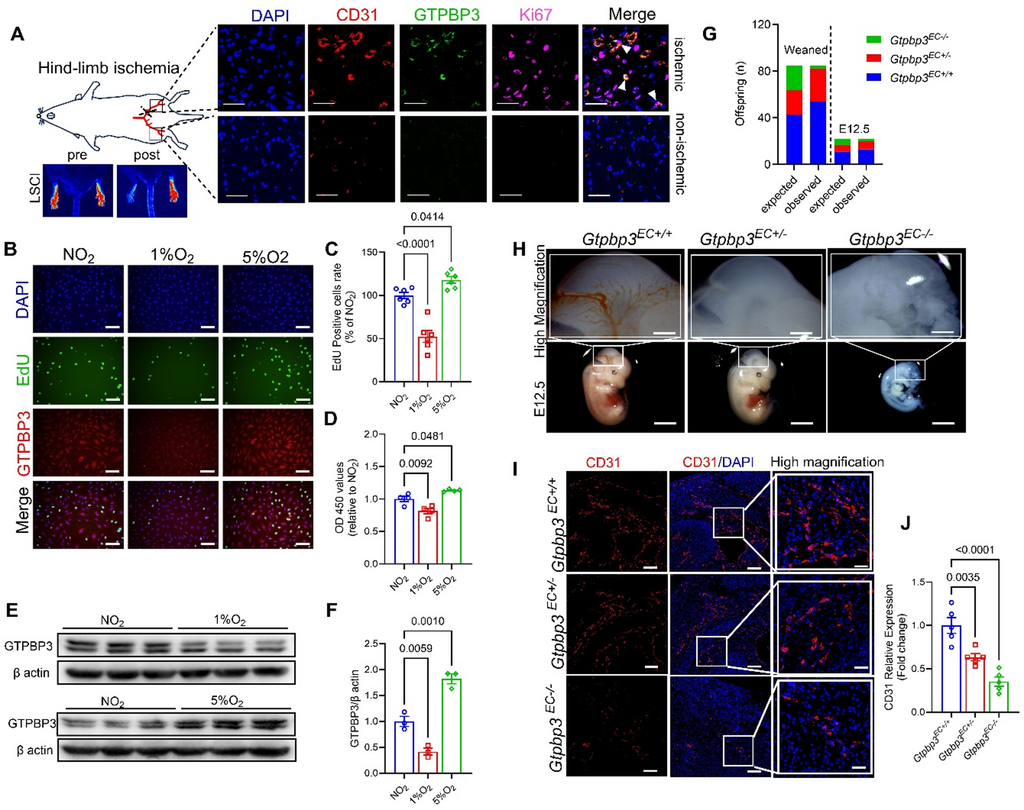 Endothelial GTPBP3 directs developmental angiogenesis and neovascularization after limb ischemia via the mtROS/HRl/ATF4/mTORC1 axis