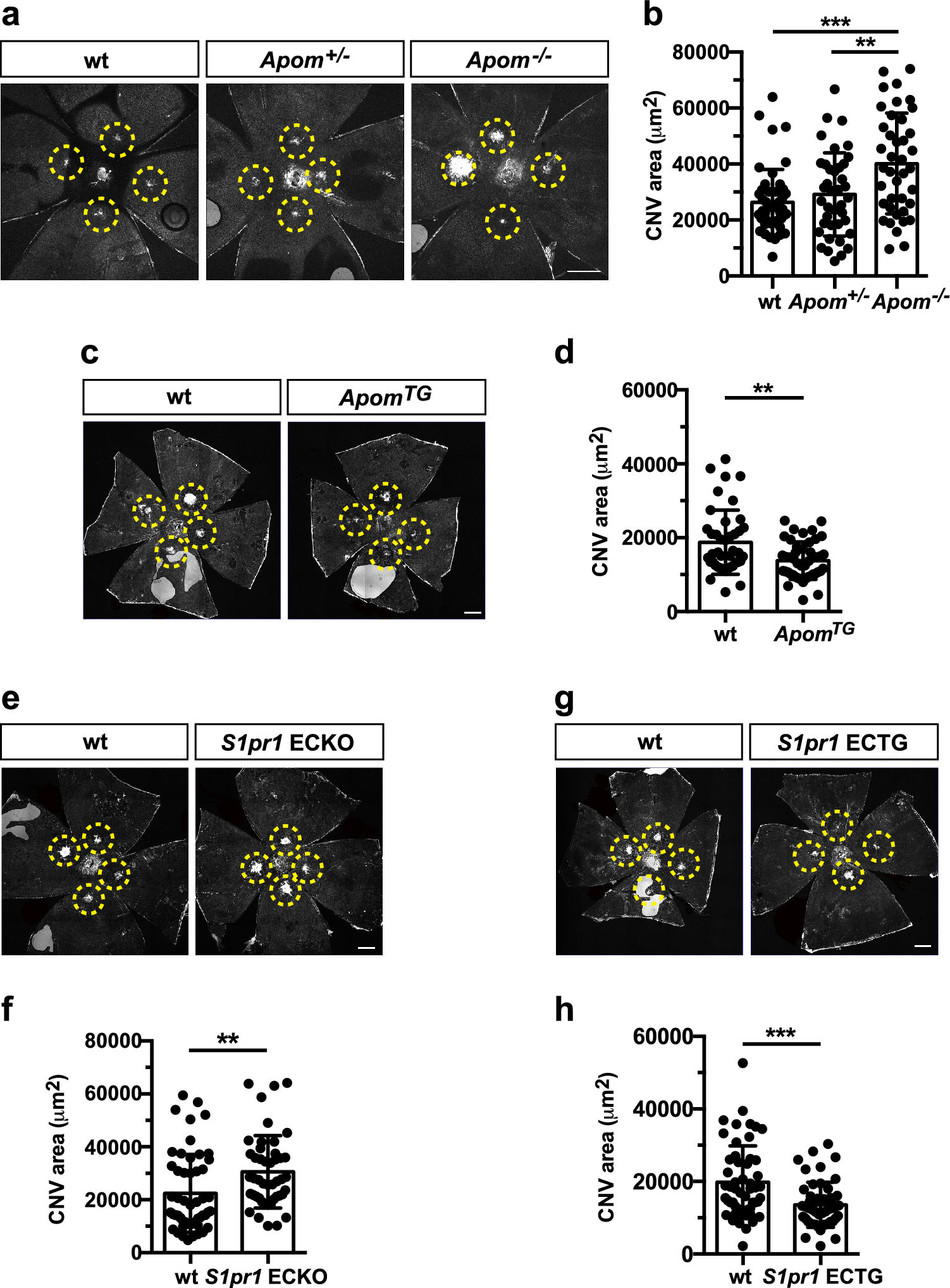 ApoM-bound S1P acts via endothelial S1PR1 to suppress choroidal neovascularization and vascular leakage