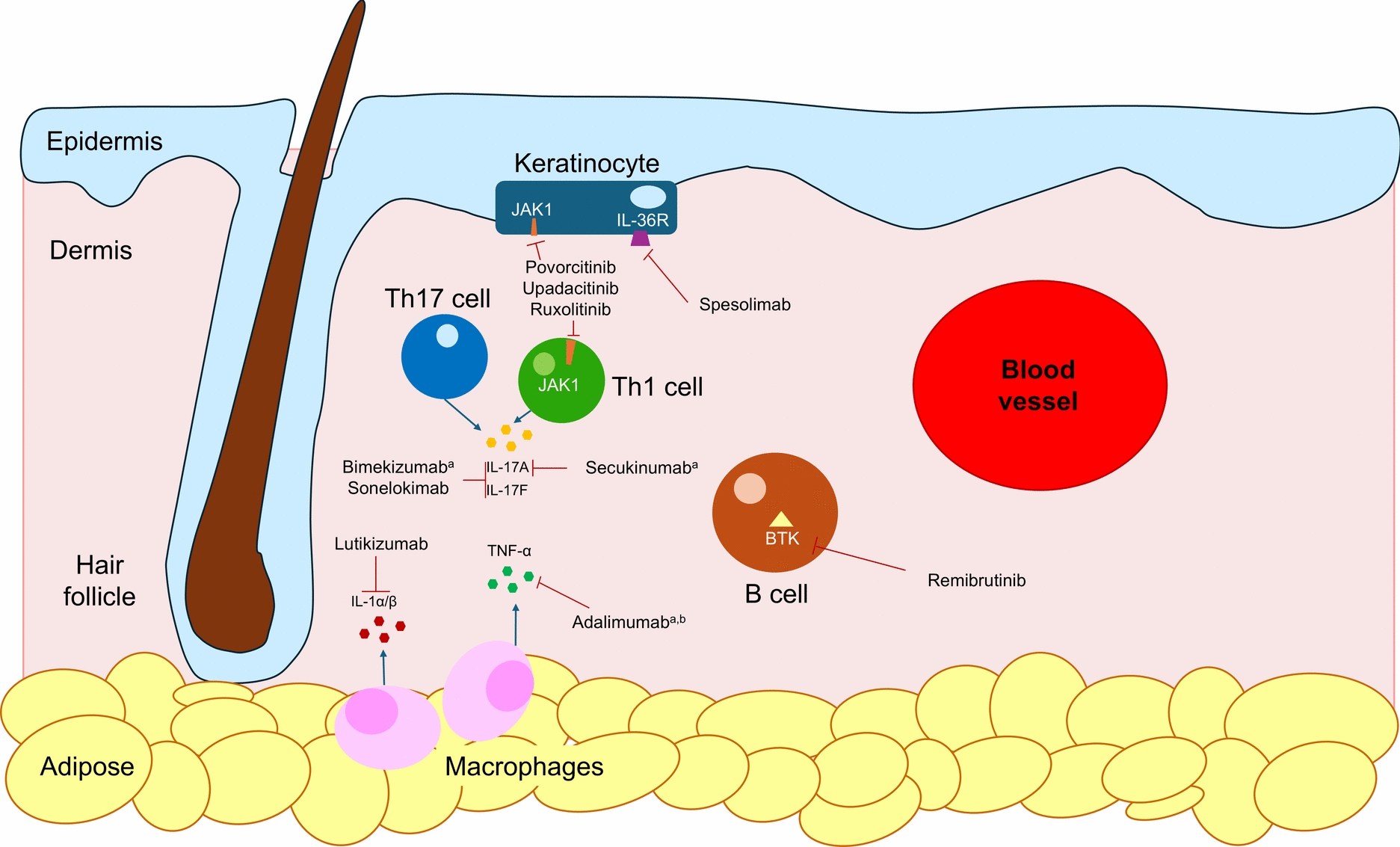 Current Treatments and Future Directions for Hidradenitis Suppurativa: a Narrative Review of Completed and Ongoing Phase 3 Clinical Trials of Biologic Therapies
