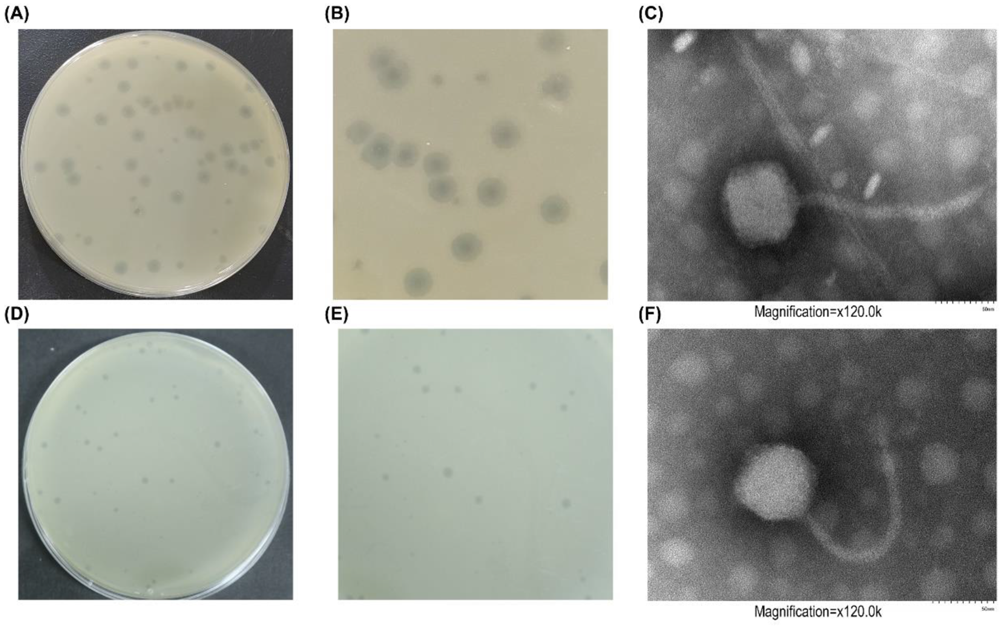 Two novel lytic bacteriophages with antibiofilm activity against carbapenem-resistant  infections