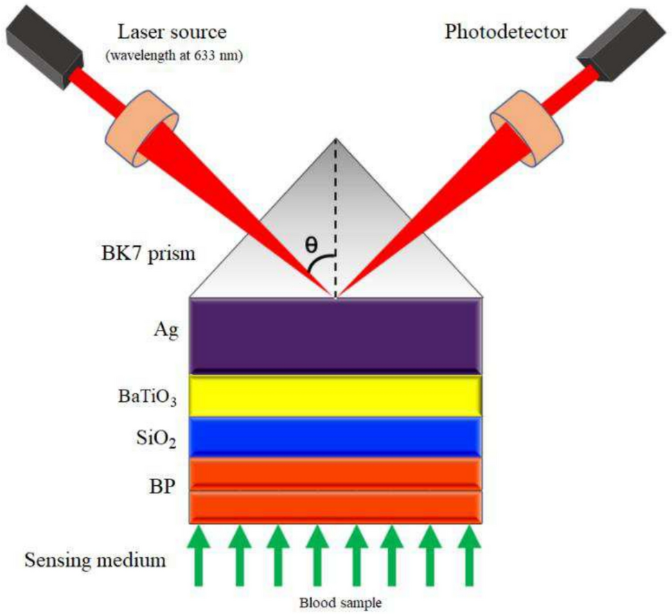 Sensitivity enhanced surface plasmon resonance biosensor for blood cancer detection